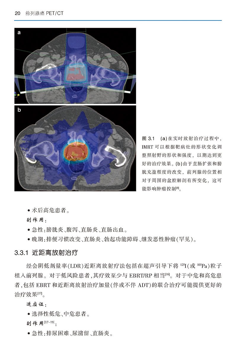 其他类别